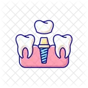 Dental implants procedure  Icon