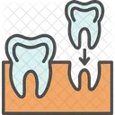 Implante De Dentes Implantes Dentarios Dental Ícone