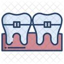 Aparatos Dentales Frenos Dientes Icon