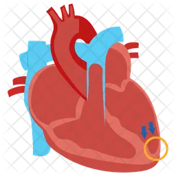 Dilated cardiomyopathy  Icon