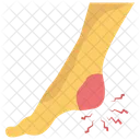 Pie Roto Lesion En El Pie Dolor Neuropatico Icono