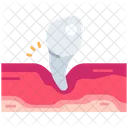 Eckzahn  Symbol