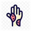 Eczema Palm Rash Icon