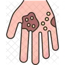 Eczema Skin Rash Icon