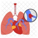 Embolie Pulmonaire Poumons Coeur Pulmonaire Icône