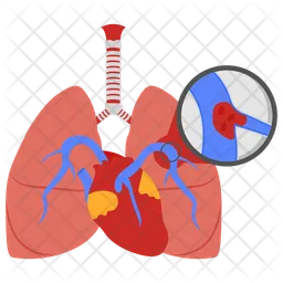 Embolie pulmonaire  Icône