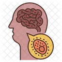 Encephalitis  Icon