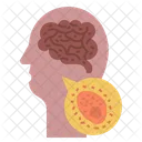 Encephalitis  Icon