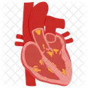 Endocardite Angina Apoplexia Ícone