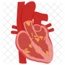 Endocarditis Angina Apoplexy Icon