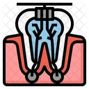 Endodontics  Icon