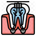 Endodontie  Symbol