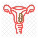 Endometrio Cancer Mama Ícone