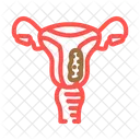 Cancer De Endometrio Mama Icono