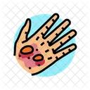 Epidermolysis Bullosa Disease Icon
