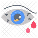 Eye Injury Acute Hyphema Eye Bruises Icon