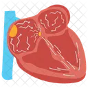 Fibrilação atrial  Ícone