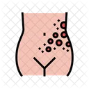 Flechte  Symbol