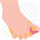 Foot Skin Infection Icon