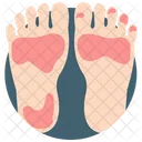 Foot Allergy  Icon