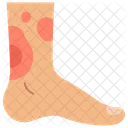 Foot Burns  Icon