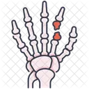 Fractura de mano  Icono
