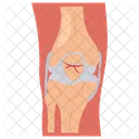 Fractured knee brace  Icon