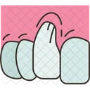 Gum Receding Periodontal Icon