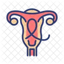 Gynecologic cancer  Icon