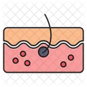 Hair Pimple Face Icon