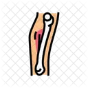 Hairline Fracture Bone Icon