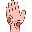 Hand Bruised Wound Icon