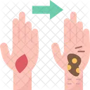 Hand Skin Burn Icon