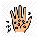 Hand Disease Dyshidrotic Eczema Icon