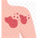 Herpes  Symbol