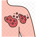 Herpes  Symbol