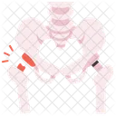 Hip Fracture  Icon