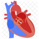 Hypotension Hypotension Orthostatique Choc Neurogene Icône