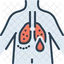 Hypoxemia  Icon