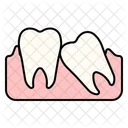 Impacted Tooth  Icon