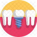 Implant Dentistry Denture Icon