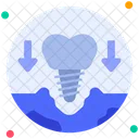Implant Surgery Tooth Icon