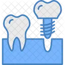 Implantes Dentarios Dente Ícone