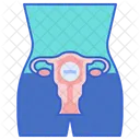 Infertility Symptoms Treatment Icon