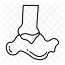 Innenknochel Symbol