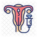 Intrauterine Insemination Uterus Insemination Impregnation Symbol