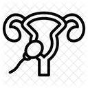 Schwanger Symbol