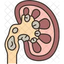 Kidney Stone Diagnosis Icon