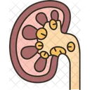 Kidney Stone Disease 아이콘