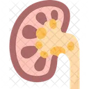 Kidney Stone Disease Icon